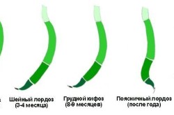 лордоз физиологический